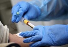 Câmara aprova campanha de prevenção a ISTs e Aids