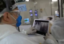 Broncopneumonia: entenda quadro que causou internação de Bolsonaro